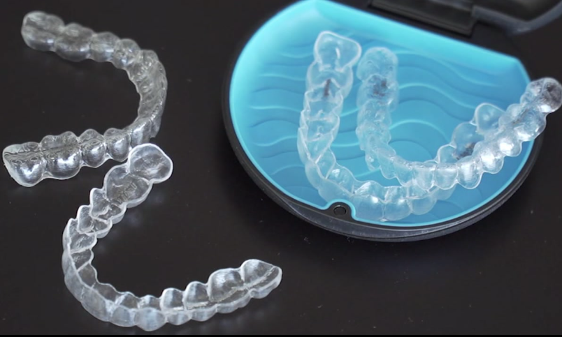 The Invisalign Process